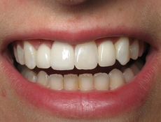 After treatment
