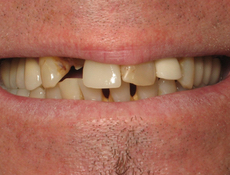 Before treatment