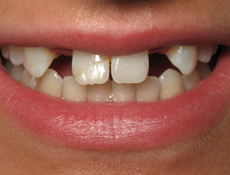 Before treatment