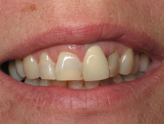 Before treatment